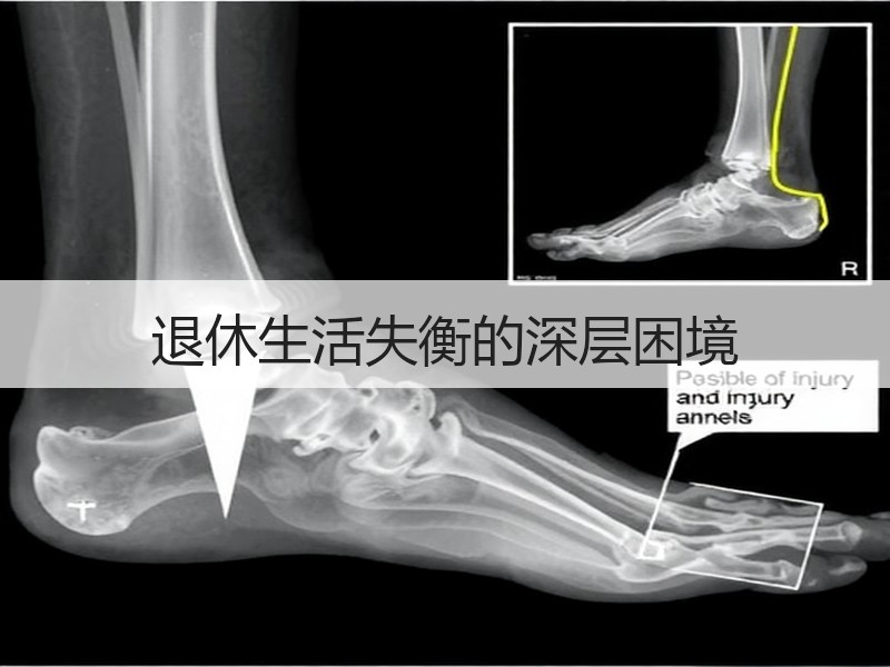 退休生活失衡的深层困境