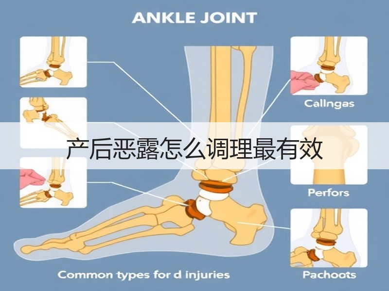 产后恶露怎么调理最有效