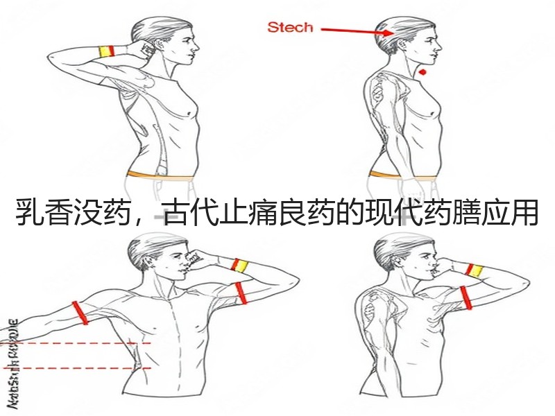 乳香没药，古代止痛良药的现代药膳应用