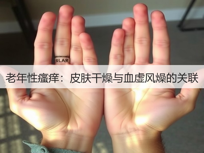 老年性瘙痒：皮肤干燥与血虚风燥的关联